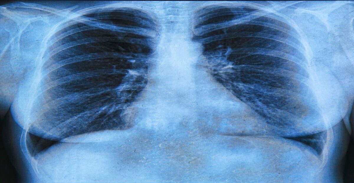 Lung Infection