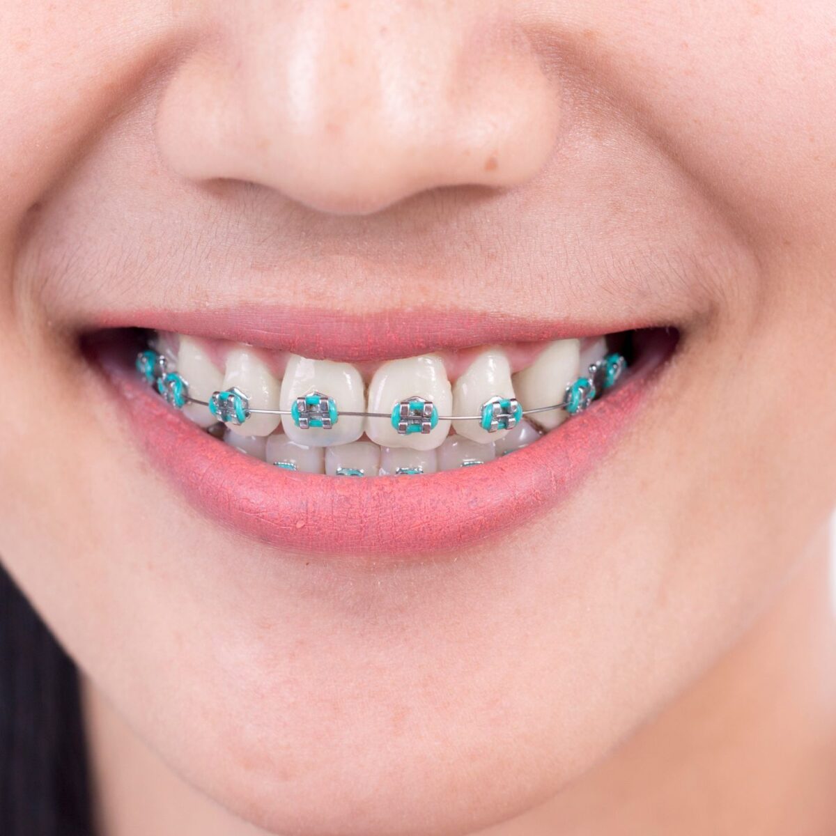 How Long Does It Take to Become an Orthodontist?
