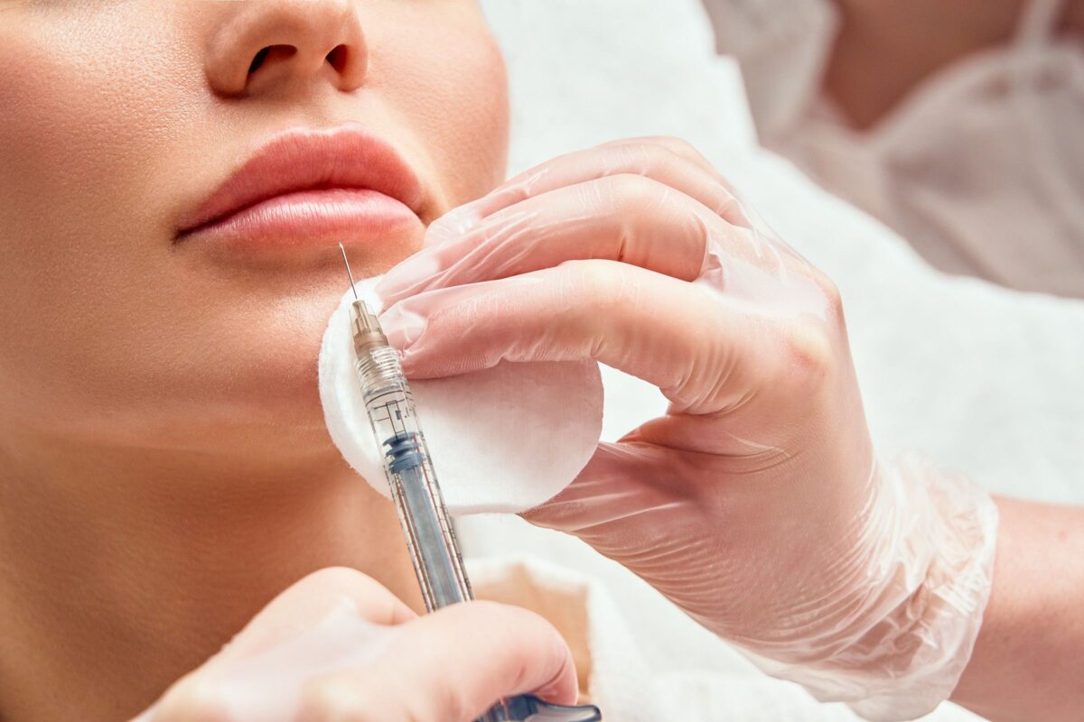Are You Ready for the Future of Lip Fillers?