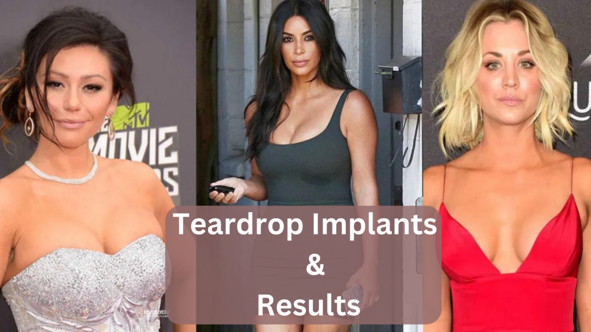 Benefits of Teardrop Implants Complete and Helpful Guide