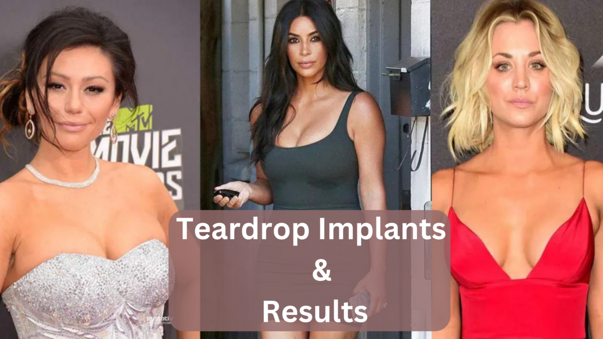 Teardrop implants
