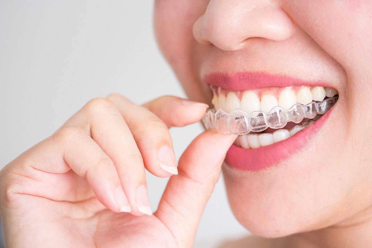 Invisalign Treatment: Tips and Tricks for Life with Teeth