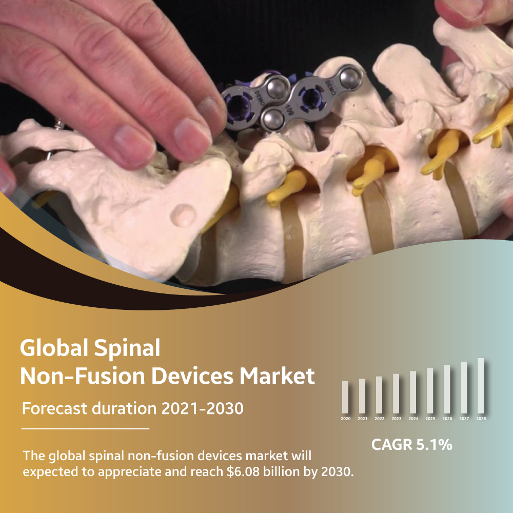 Detailed Overview Of Spinal Non-Fusion Devices Market