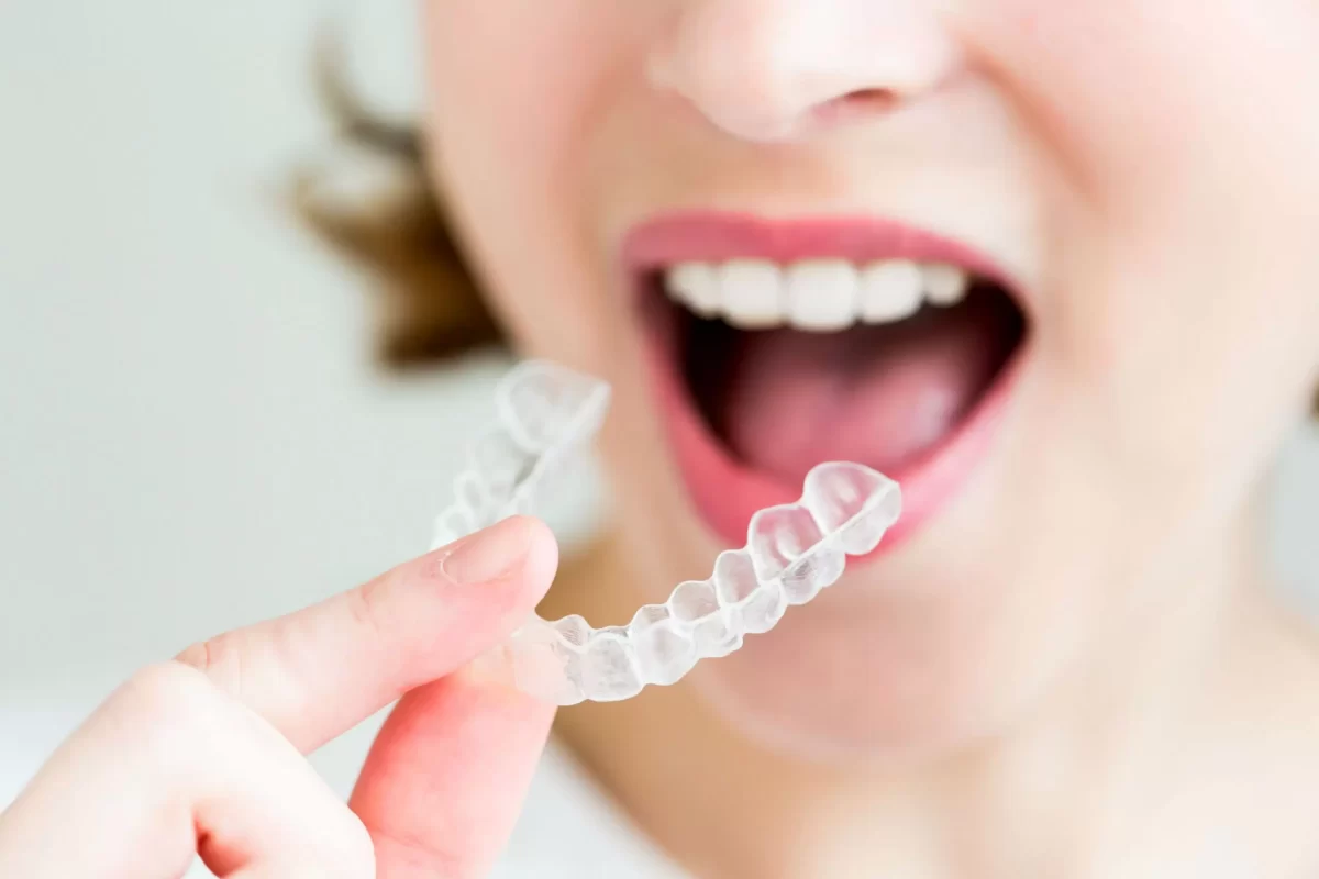 Invisalign Treatment Manchester: Transform Your Smile with Confidence