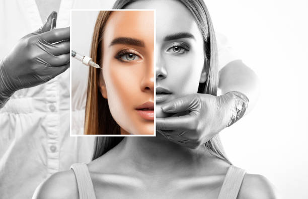 The Ultimate Guide to Botox Injections: Dubai’s Top Clinics Unveiled
