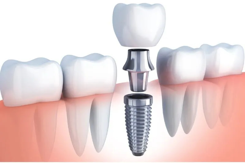 Transforming Smiles Together: Family Orthodontics Services in McKinney, TX