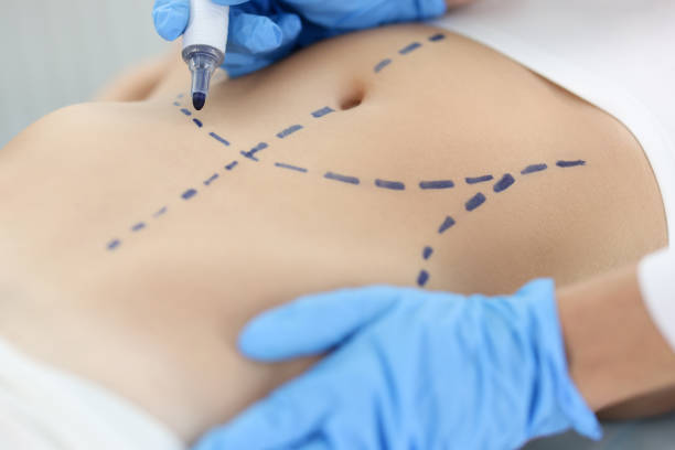 “Dubai’s Premier Liposuction Clinics: A Comprehensive Guide”