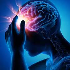 Epilepsy: Understanding the Condition and Its Impact