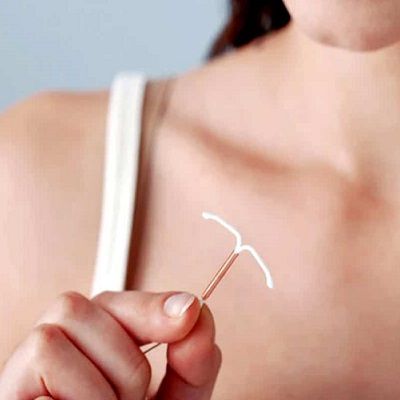 A Comprehensive Guide: IUD Insertion Copper in Dubai