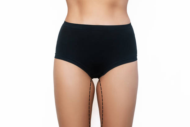 Streamlined Silhouette: Liposuction in Riyadh for You