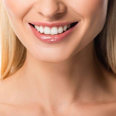 Beaming Confidence: Teeth Whitening in Islamabad
