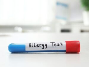 allergy testing