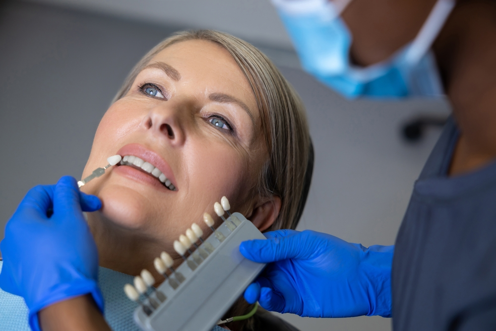 dental veneers