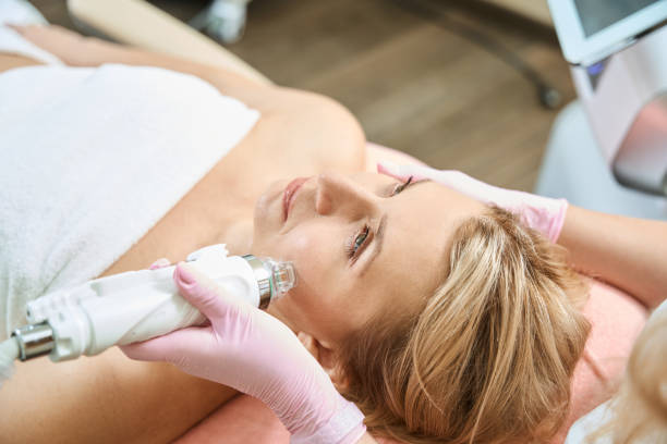 RF microneedling boston