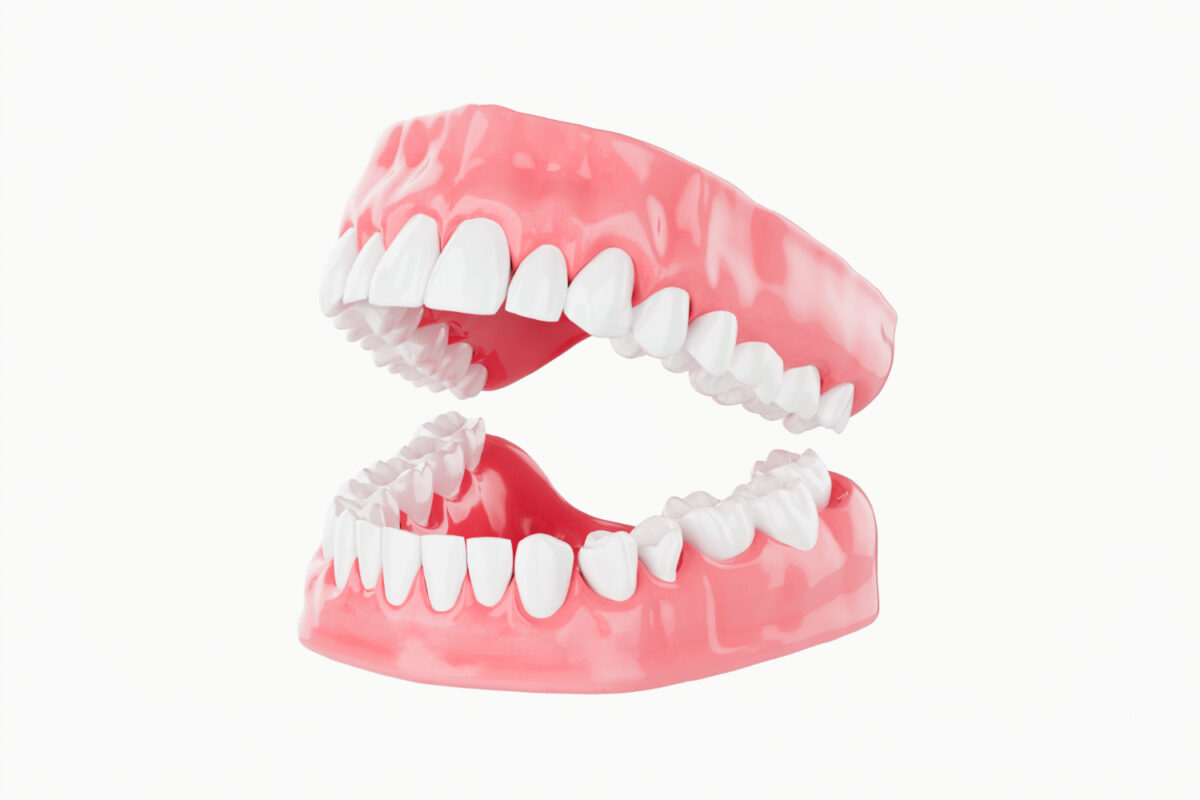 Why Choosing the Right Dentures Service in Noida is Crucial for Your Oral Health?