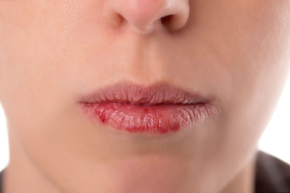 Preparatory tips for lip size reduction and gender reassignment surgeries 