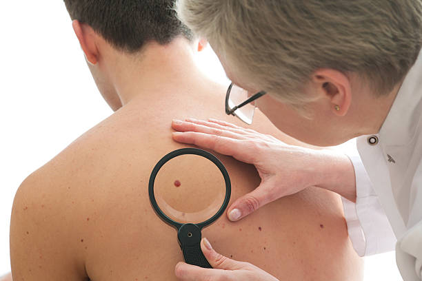 Your Skin's Blueprint: Dermoscopy in Riyadh Revealed