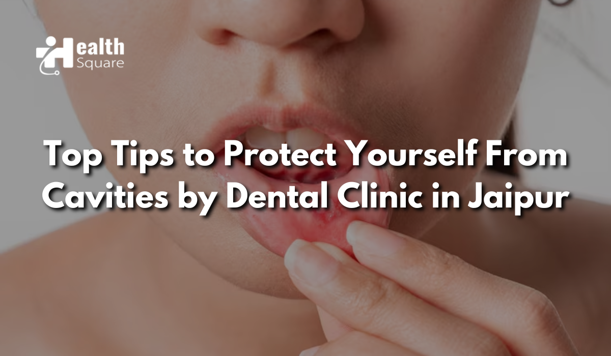 Top Tips to Protect Yourself From Cavities by Dental Clinic in Jaipur