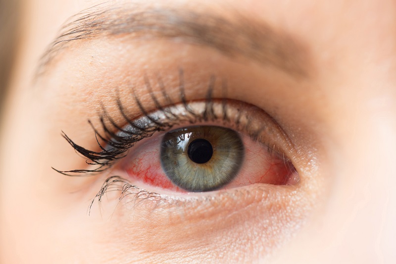 Guide Through Medical and Surgical Interventions for Dry Eyes Treatment