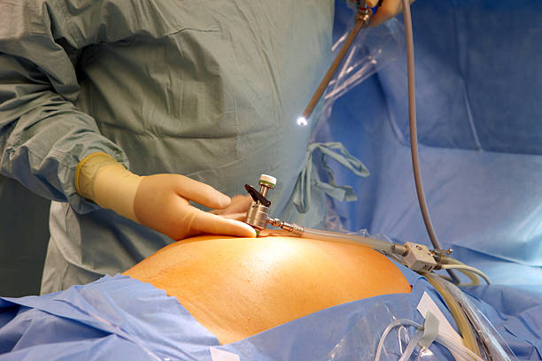 Redefining Weight Loss: Discover Endoscopic Balloons in Riyadh