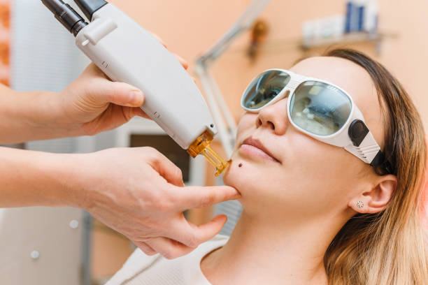 Experience the Magic of Laser Eye Lifts in Riyadh