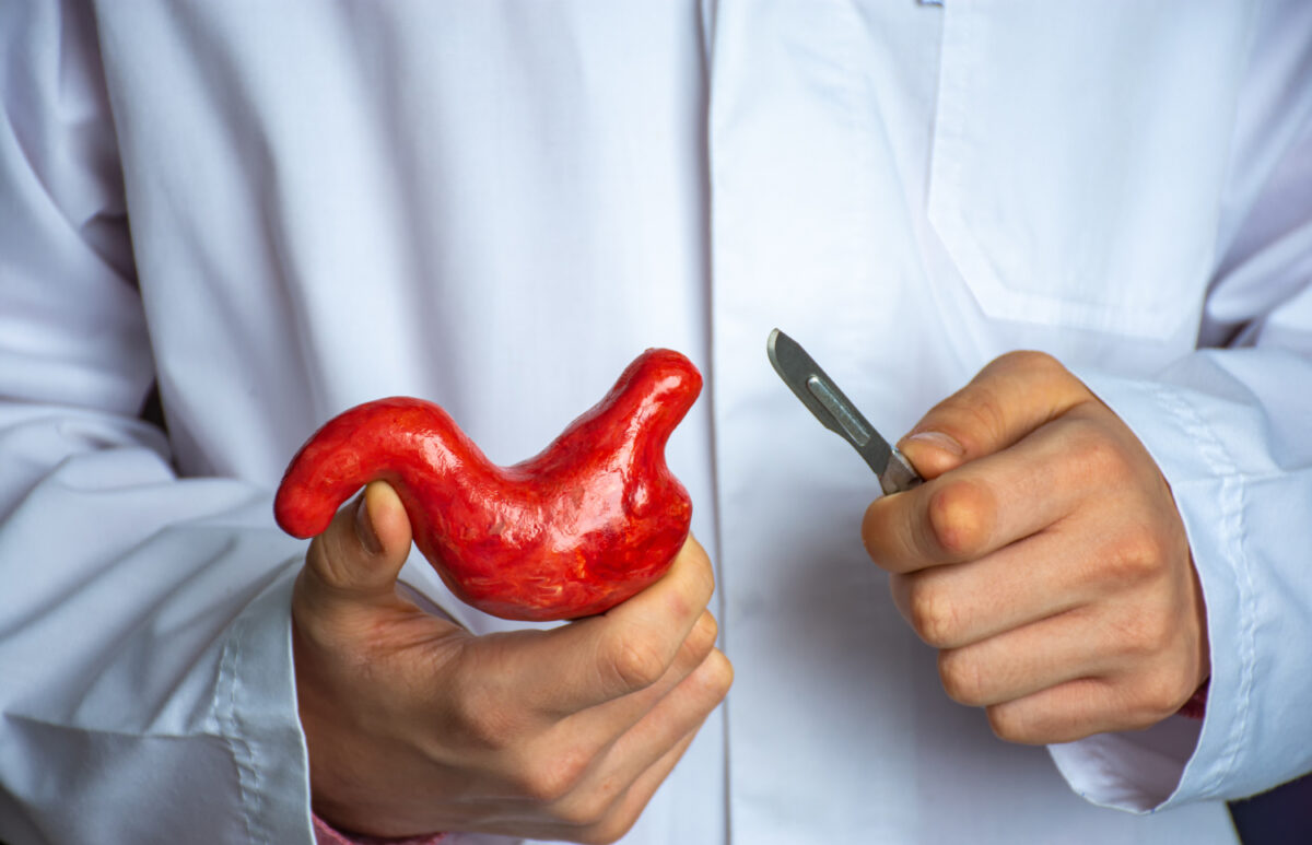 What to Ask Your Doctor About Bariatric Surgery in Islamabad
