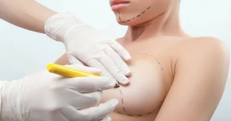 A woman undergoing breast surgery, preparing for her breast implant procedure in a clinical setting.