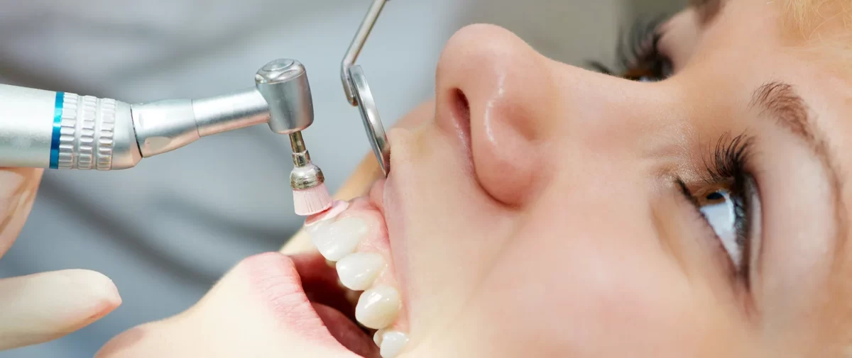 Affordable Teeth Scaling in Islamabad: What to Expect