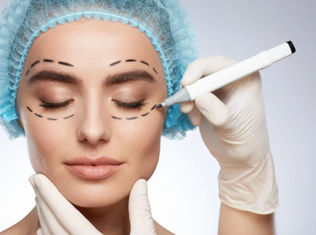 Everything You Need to Know About Eyelid Surgery in Islamabad