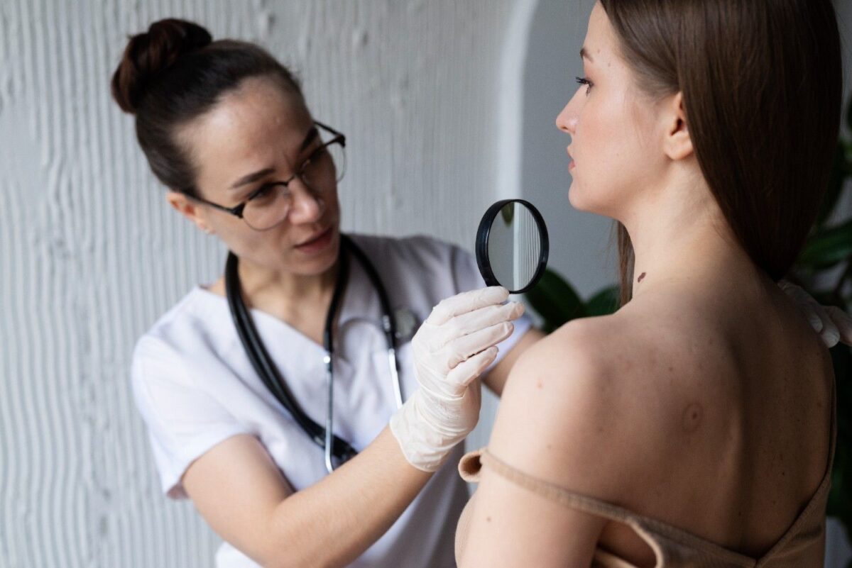 Choosing a Mole Removal Specialist in Sydney: Key Factors
