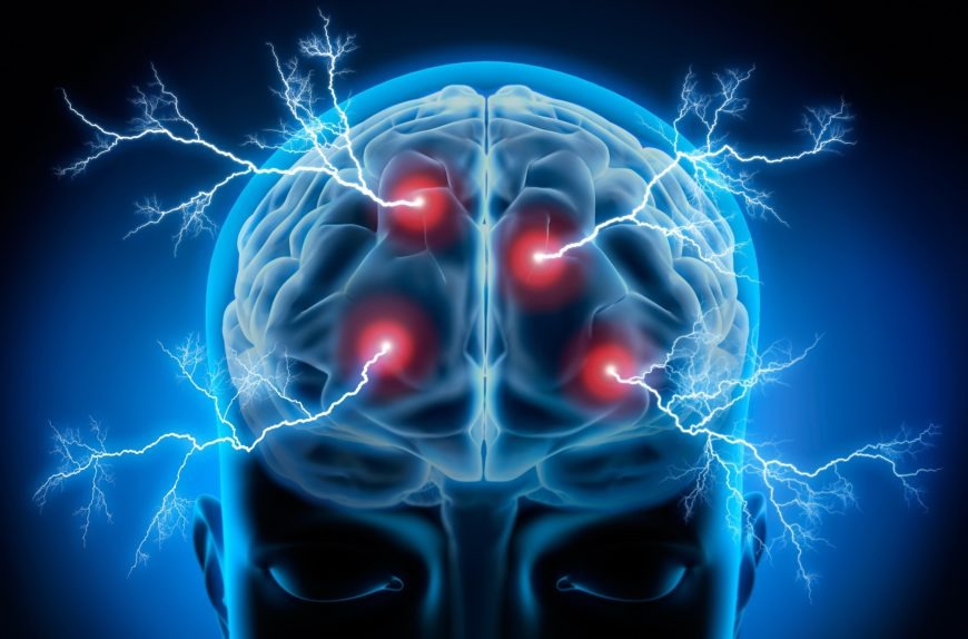 Brain Recovery Centre in Gurgaon: Top Treatments for Neurological Healing