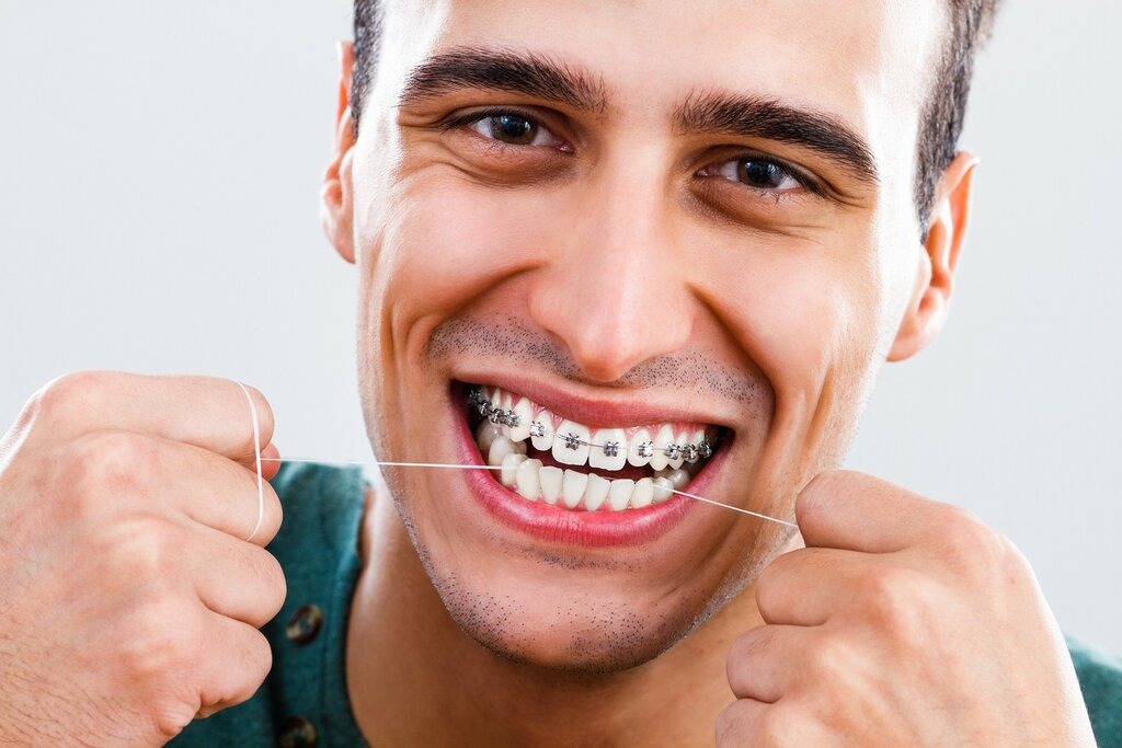 Finding the Right Orthodontist in Christchurch: Key Factors to Consider for a Perfect Smile