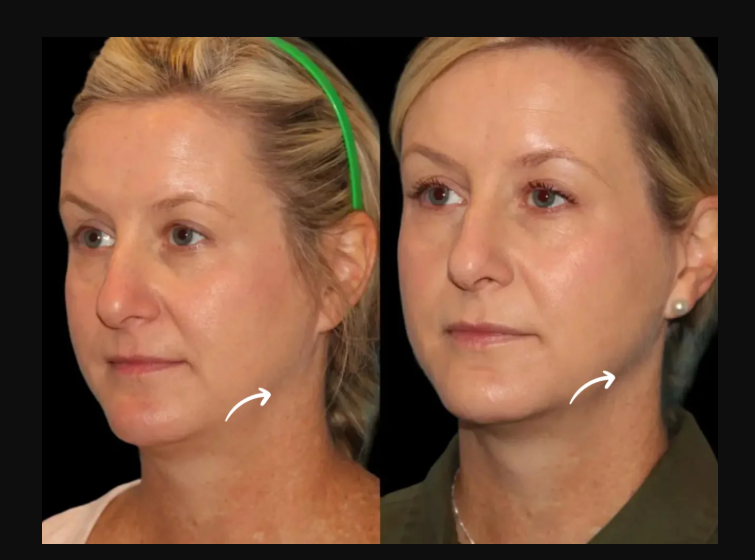 Best Aesthetic Clinic in dubai