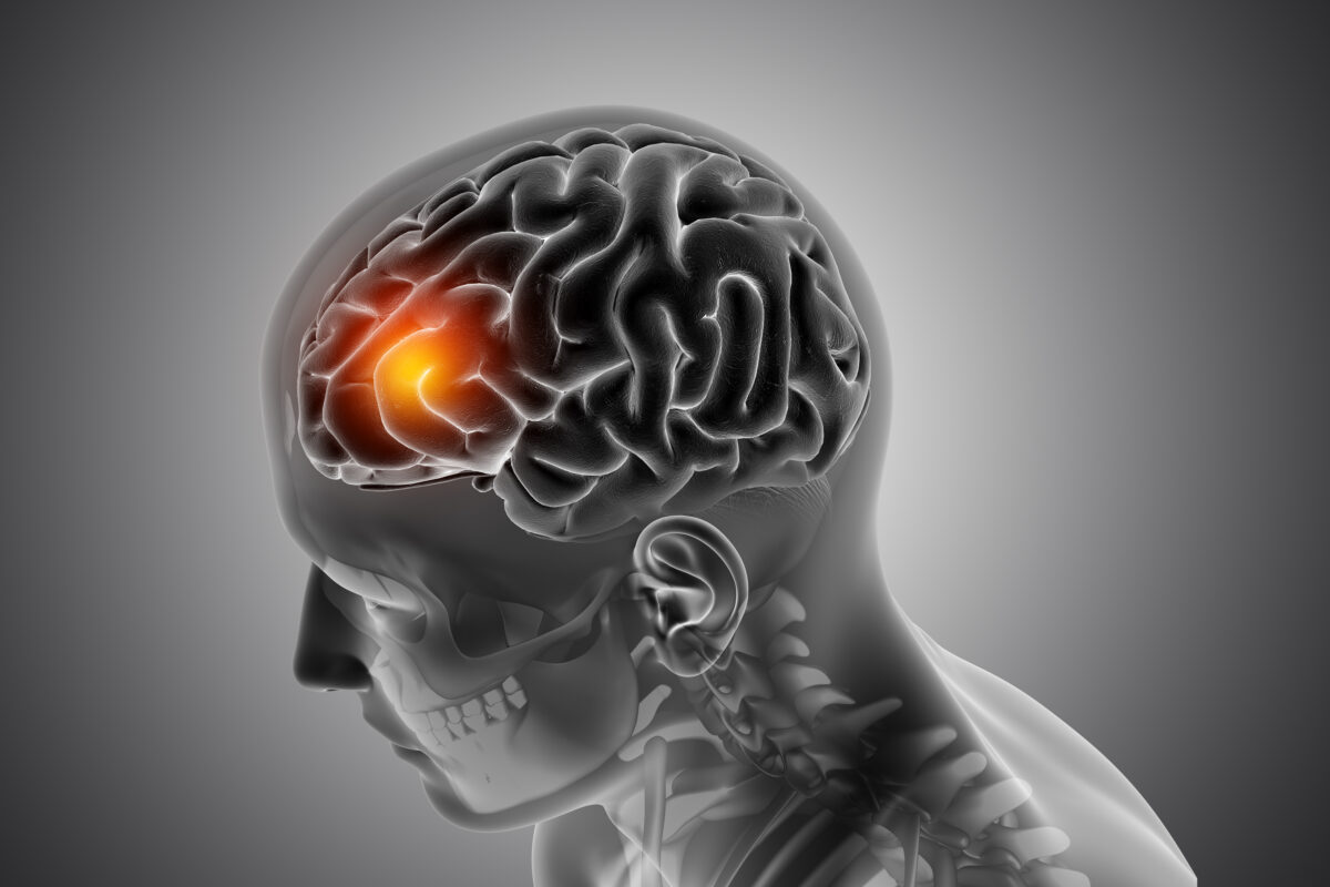 Understanding Traumatic Brain Injuries: Diagnosis and Care