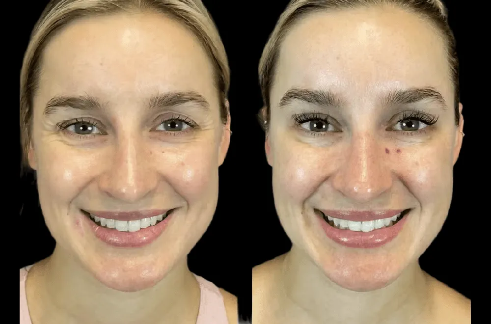 Latest Botox Innovations from the Best Plastic Surgeon in dubai