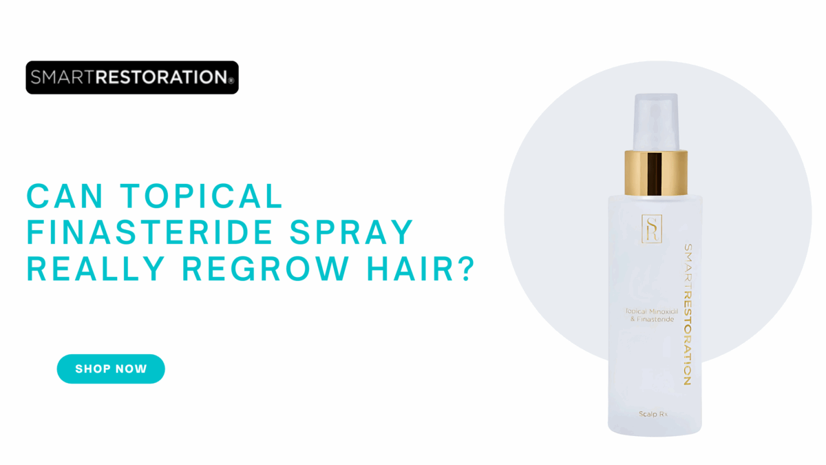 Topical Finasteride Spray