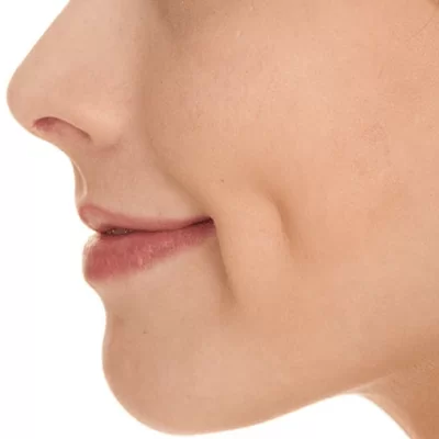 How Long Until You See Full Results from Dimple Surgery?