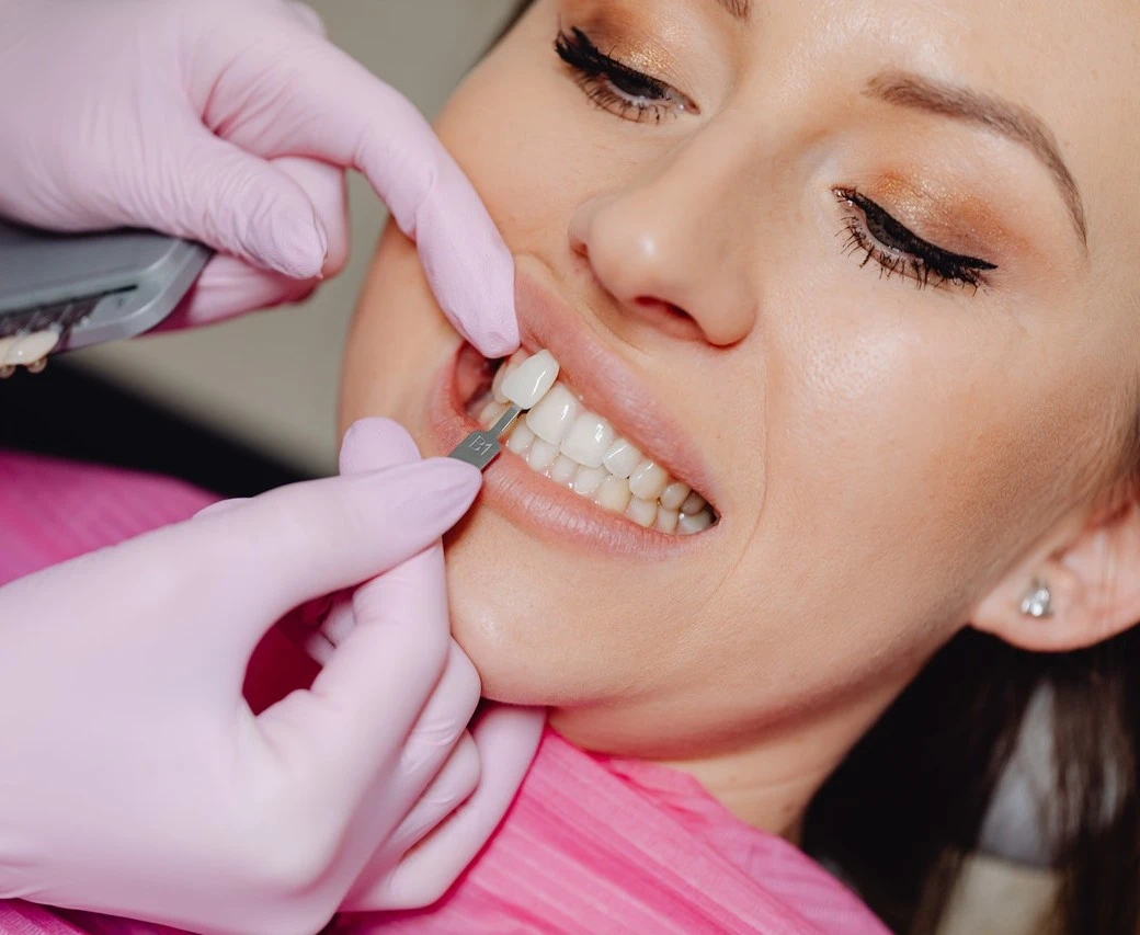 Caring for Your Veneers in Dubai: Tips for Long-Lasting Results
